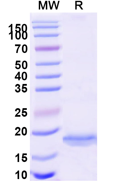 SDS-PAGE for Anti-Human BACE2 VHH (SAA1030)