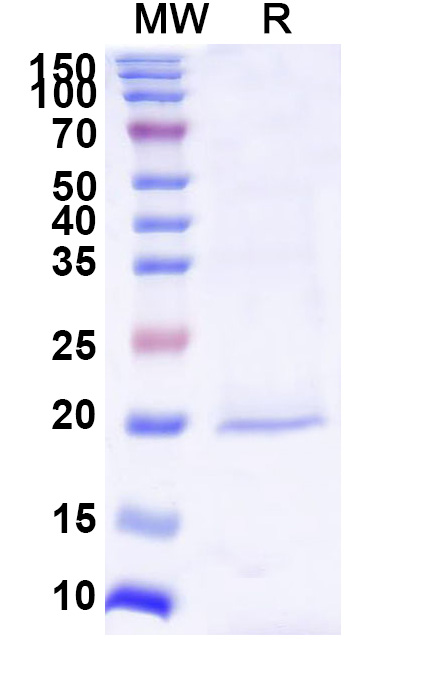 SDS-PAGE for Anti-Human BIRC5 VHH (SAA1237)