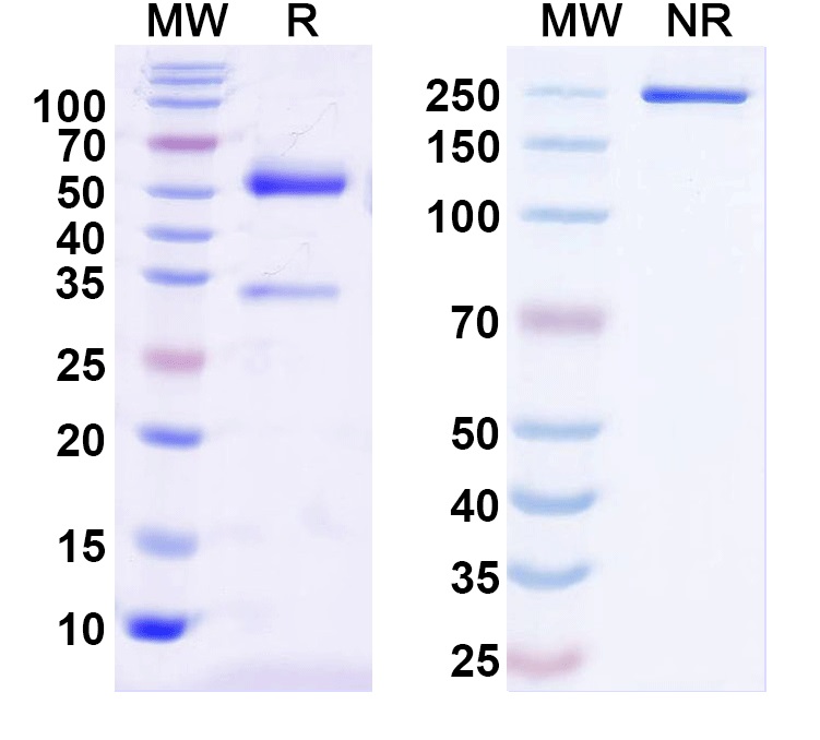 SDS-PAGE for Anti-Human BRD7 IP Antibody (SAA0193)