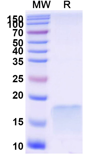 SDS-PAGE for Anti-Human C6/Complement C6 VHH (SAA1039)