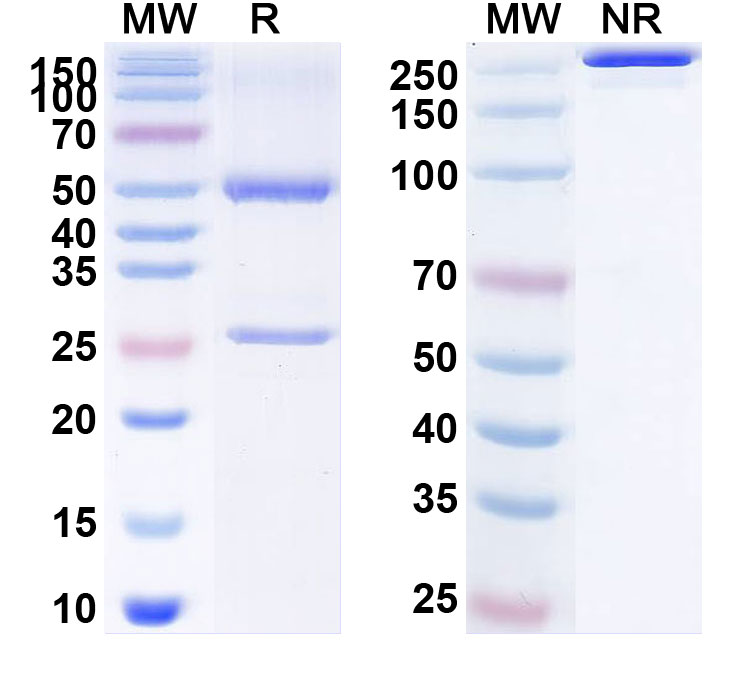 SDS-PAGE for Anti-Human CALD1 Monoclonal Antibody (1A551)