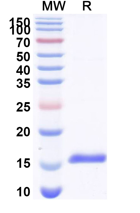 SDS-PAGE for Anti-Human CASR VHH (SAA1046)