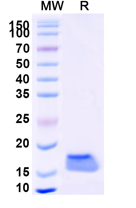 SDS-PAGE for Anti-Human CAT/Catalase VHH (SAA1202)