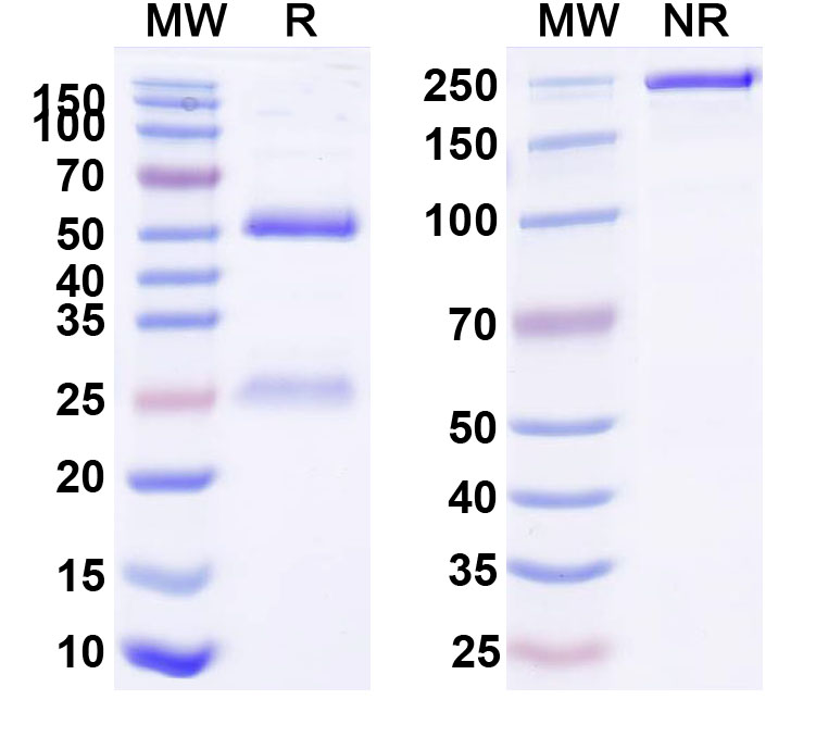 SDS-PAGE for Anti-Human CBX1 IP Antibody (SAA0195)