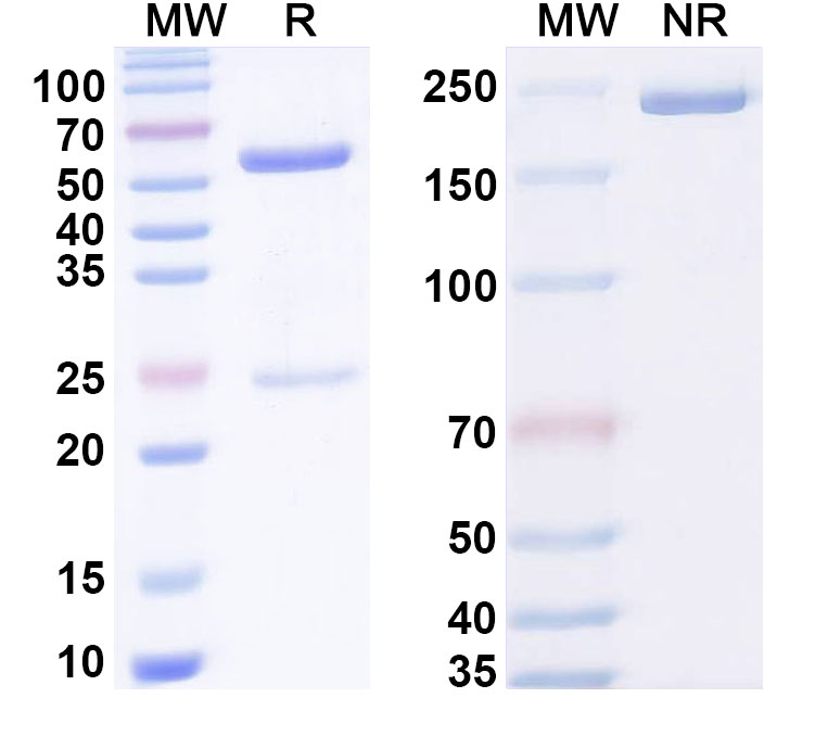 SDS-PAGE for Anti-Human CBX2 Antibody (ABS1882)