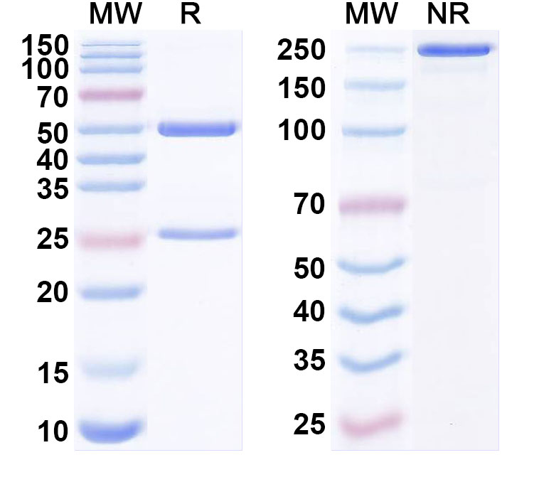 SDS-PAGE for Anti-Human CBX8 IP Antibody (SAA0261)