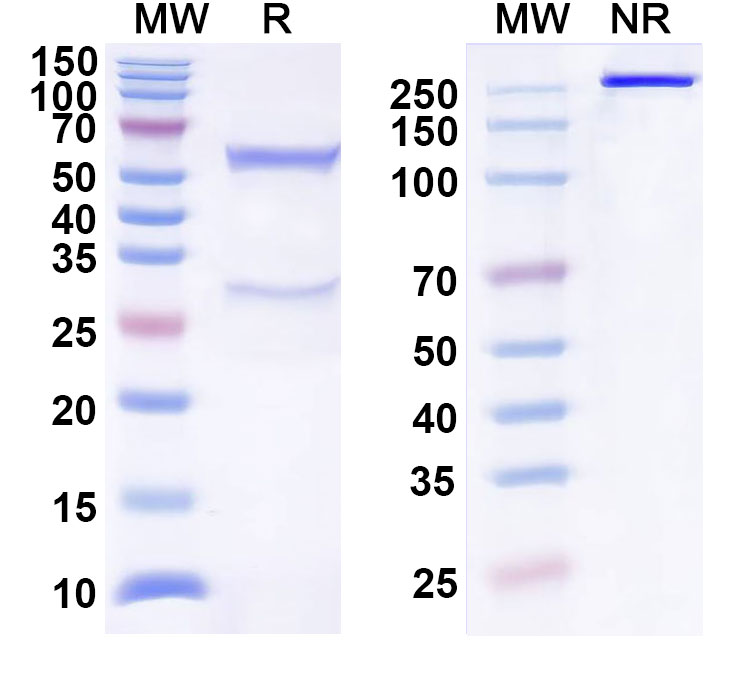 SDS-PAGE for Anti-Human CCL17/TARC Antibody (SAA0460)
