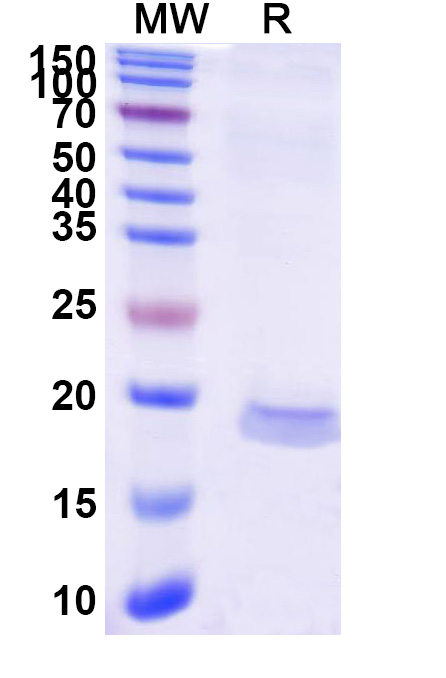 SDS-PAGE for Anti-Human CCL2/MCP-1 VHH (SAA1269)