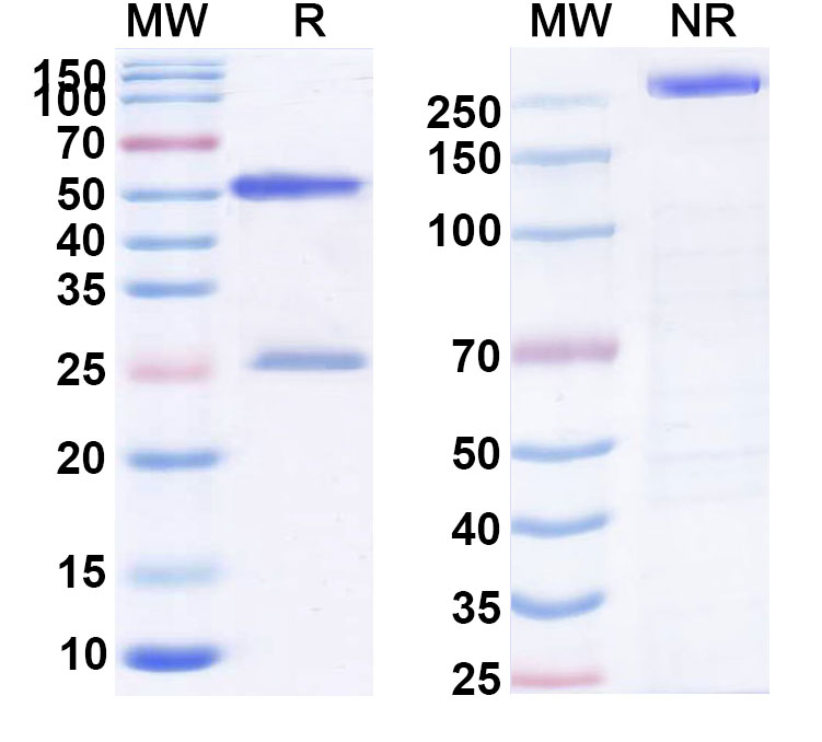 SDS-PAGE for Anti-Human CCR4/CNOT6 (AT007)