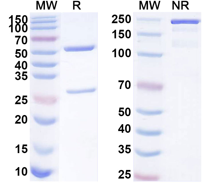 SDS-PAGE for Anti-Human CCSAP Antibody (ABS0590)