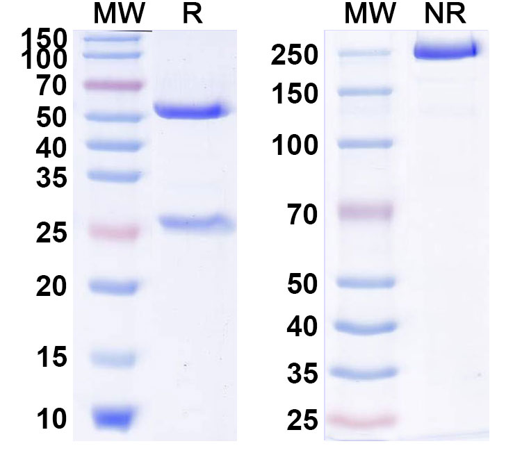 SDS-PAGE for Anti-Human CD121a/IL1R1 (MEDI8968)