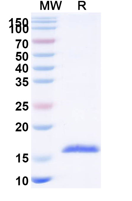 SDS-PAGE for Anti-Human CD154/CD40LG/TNFSF5 VHH (SAA1196)