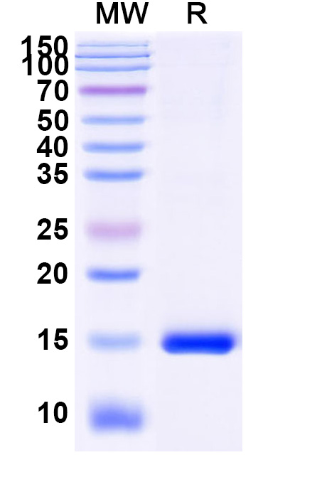 SDS-PAGE for Anti-Human CD156c/ADAM10 VHH (SAA1217)