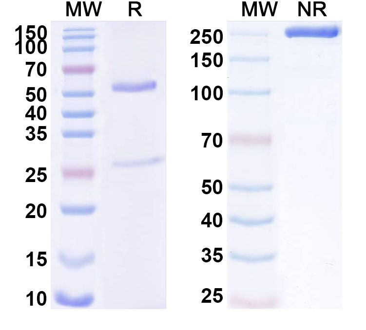 SDS-PAGE for Anti-Human CD172b/SIRPB1 Monoclonal Antibody (ABS1422)