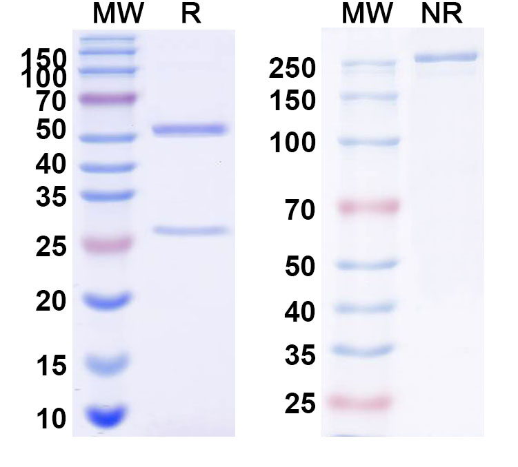 SDS-PAGE for Anti-Human CD21/CR2 Monoclonal Antibody (1A615)