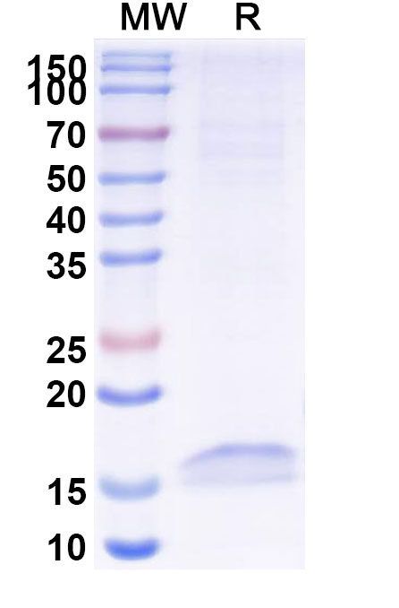 SDS-PAGE for Anti-Human CD326/EPCAM VHH (SAA1341)