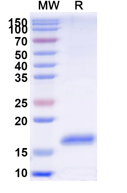 SDS-PAGE for Anti-Human CD369/CLEC7A VHH (SAA1364)
