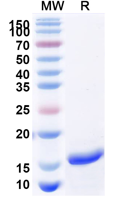 SDS-PAGE for Anti-Human CD38/ADPRC 1 VHH (SAA0895)
