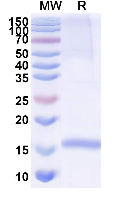 SDS-PAGE for Anti-Human CD49c/ITGA3 VHH (SAA1303)