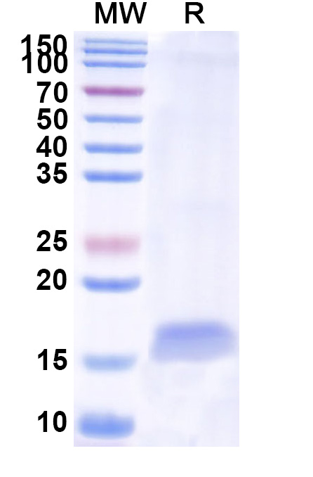 SDS-PAGE for Anti-Human CD49e/ITGA5 VHH (SAA1304)