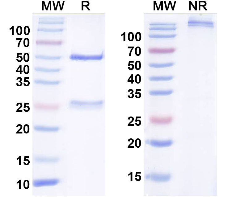 SDS-PAGE for Anti-Human CD56/NCAM1 Monoclonal Antibody (1A485)