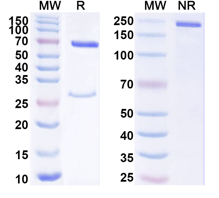 SDS-PAGE for Anti-Human CDH11 Antibody (ABS1226)