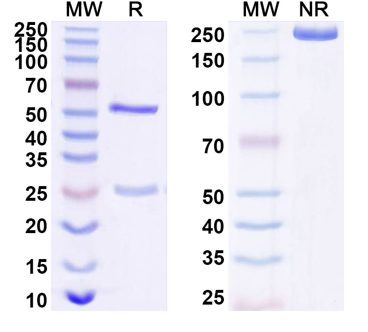 SDS-PAGE for Anti-Human CDON Antibody (ABS2145)