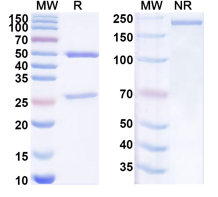 SDS-PAGE for Anti-Human CLTRN/Tmem27 Antibody (ABS1919)