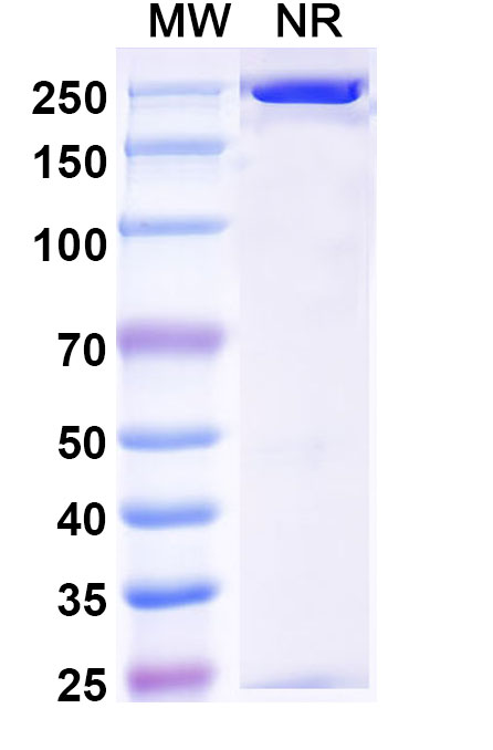 SDS-PAGE for Anti-Human Complement C5b-9 Complex Antibody (aE11#)