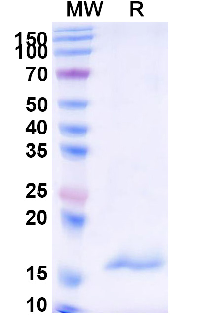 SDS-PAGE for Anti-Human CPB2 VHH (SAA1018)