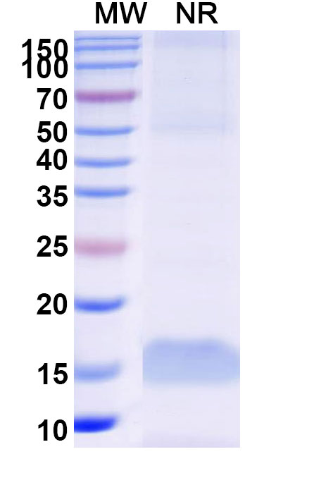 SDS-PAGE for Anti-Human CPB2 VHH (SAA1017)
