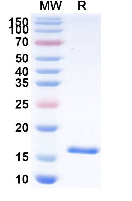 SDS-PAGE for Anti-Human CPB2 VHH (SAA1041)