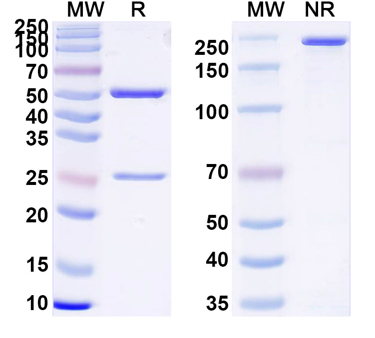 SDS-PAGE for Anti-Human CSPG5 Antibody (CSPG5202)