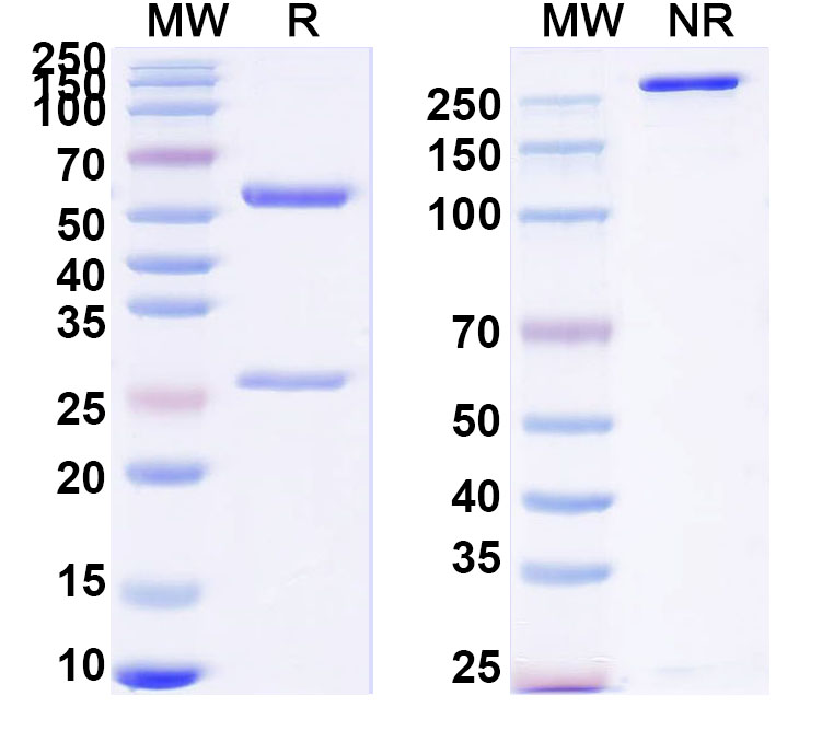 SDS-PAGE for Anti-Human CST3/Cys C Monoclonal Antibody (1A384)