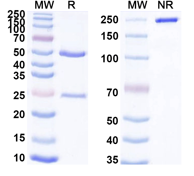 SDS-PAGE for Anti-Human CTSB Monoclonal Antibody (1A489)