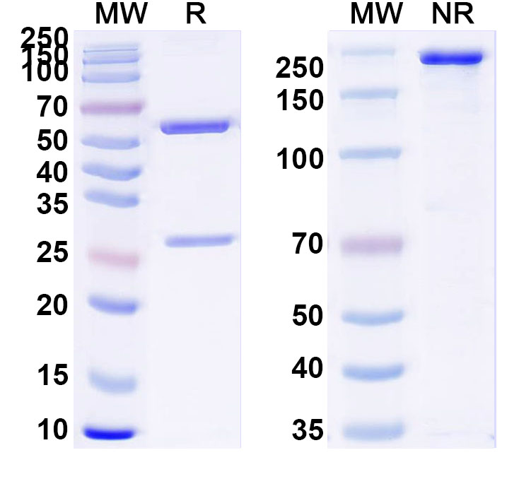 SDS-PAGE for Anti-Human CTSB Monoclonal Antibody (2A2)