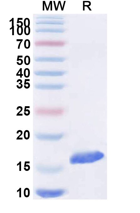 SDS-PAGE for Anti-Human DCX VHH (SAA1176)