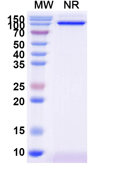 SDS-PAGE for Anti-Human DKK1 Antibody (SAA1268)