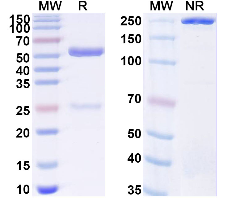 SDS-PAGE for Human DNMT1 IP Monoclonal Antibody SAA0251