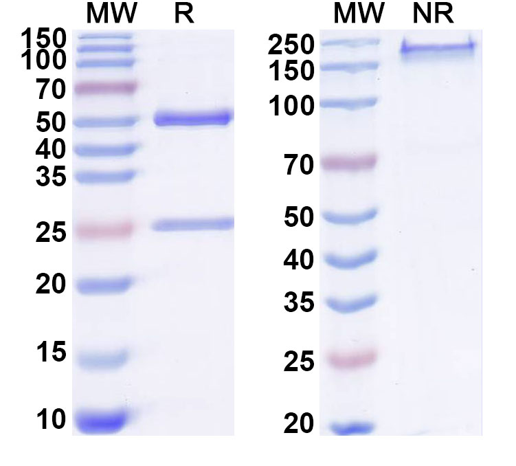 SDS-PAGE for Anti-Human DPP3 Monoclonal Antibody (ABS1116)