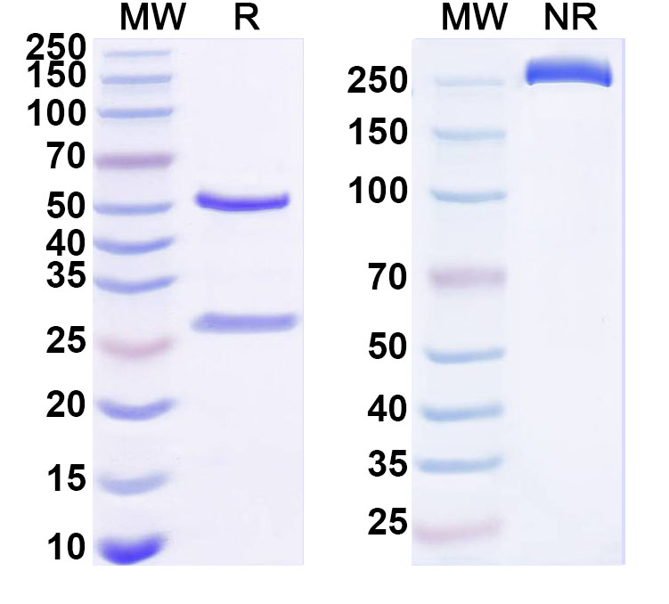 SDS-PAGE for Anti-Human DSC2 Antibody (ABS1191)