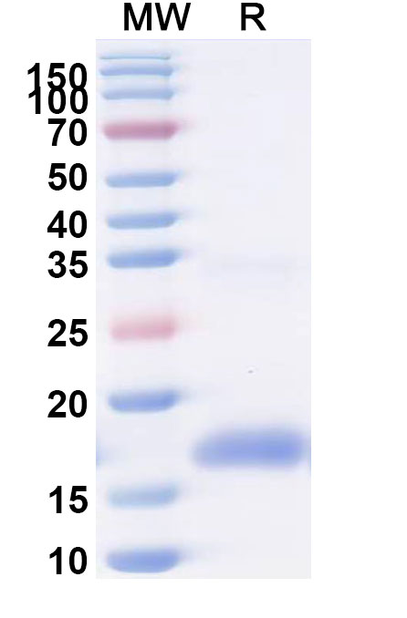 SDS-PAGE for Anti-Human EGFR/ERBB1/HER1 VHH (SAA0906)
