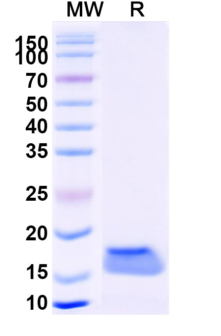 SDS-PAGE for Anti-Human EGFR/ERBB1/HER1 VHH (SAA1213)