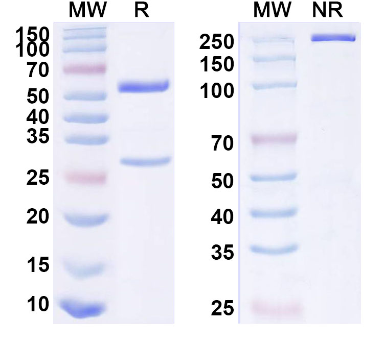 SDS-PAGE for Anti-Human ENPP1 Antibody (ABS0613)