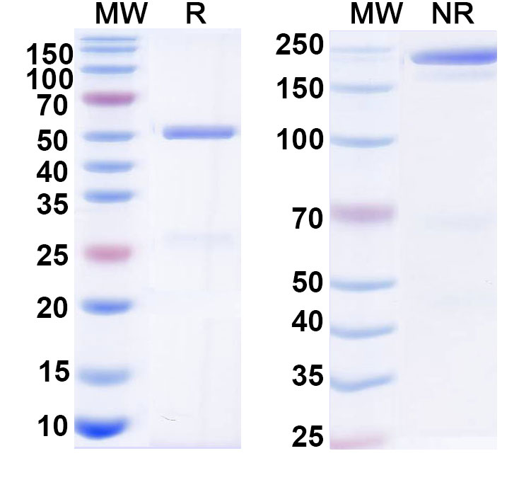 SDS-PAGE for Anti-Human ESR1/ER-alpha Monoclonal Antibody (RB125)
