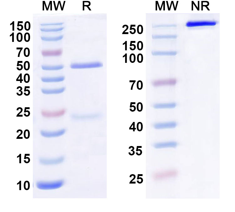SDS-PAGE for Anti-Human ETBR Antibody (SAA0780)