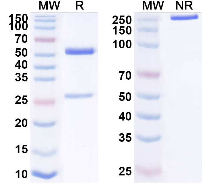 SDS-PAGE for Anti-Human ETV1 Antibody (ABS0862)