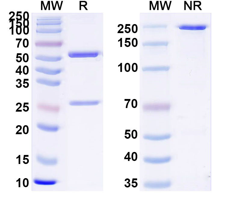 SDS-PAGE for Anti-Human F7/Coagulation factor VII Monoclonal Antibody (3A4)