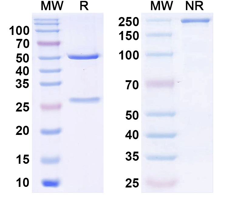 SDS-PAGE for Anti-Human F8/Coagulation factor VIII Antibody (Iv0204)
