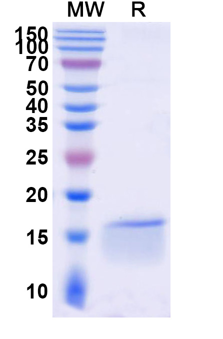 SDS-PAGE for Anti-Human FOS VHH (SAA1335)